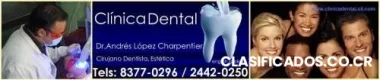 Blanqueamiento dental laser
